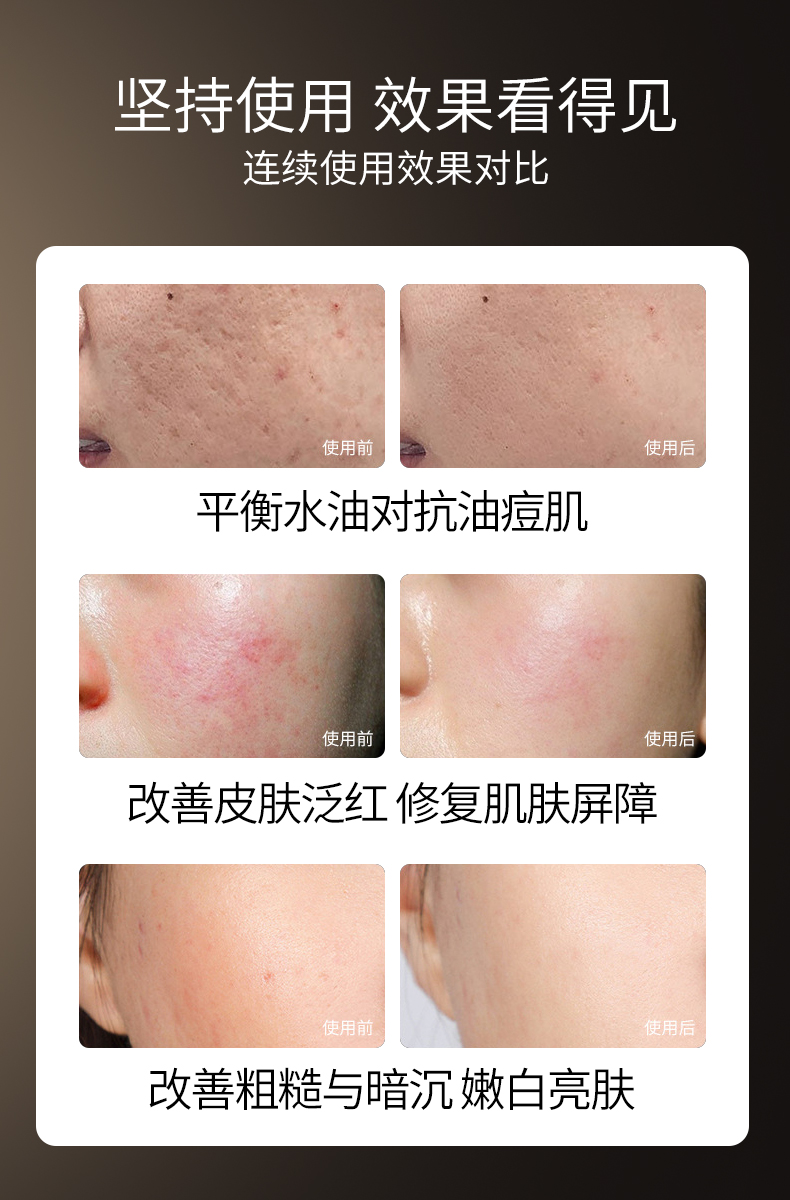 光能面罩美容仪