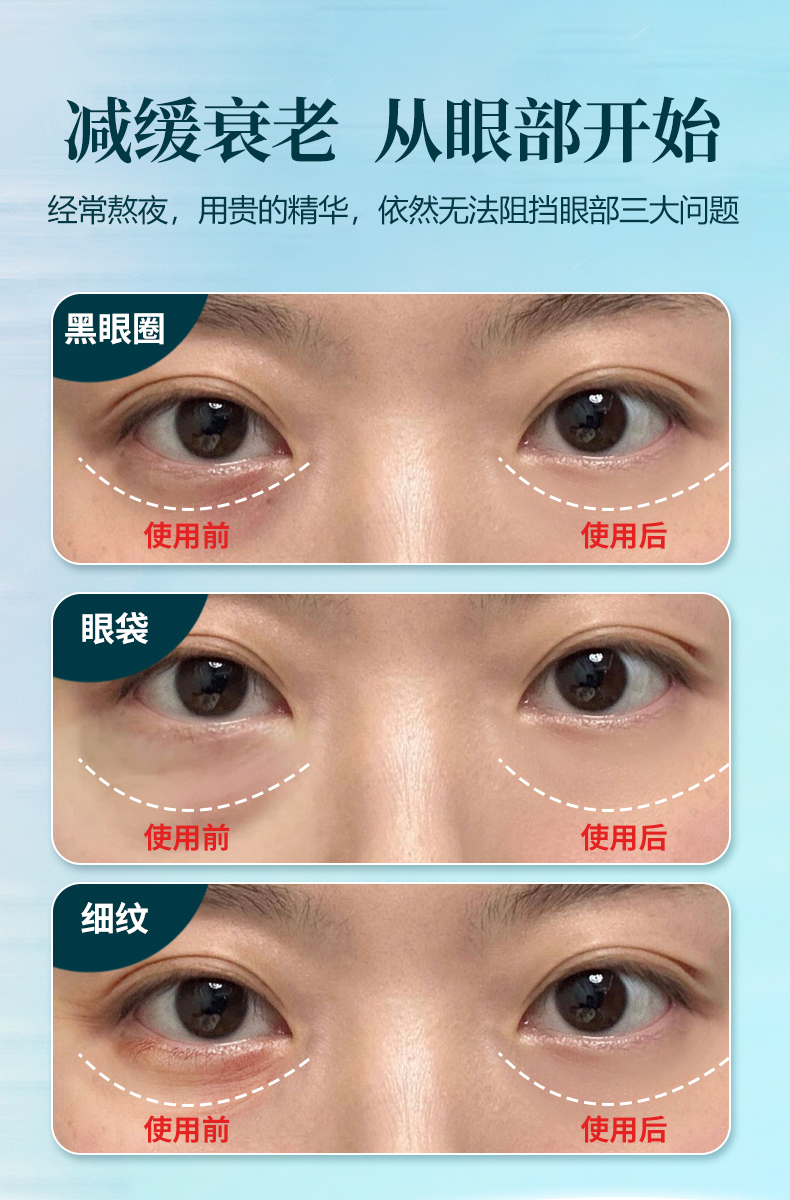 集彩光护肤、高频震动、眼部赋活、提拉眼周、恒温热敷五大功能于一体的美眼仪。