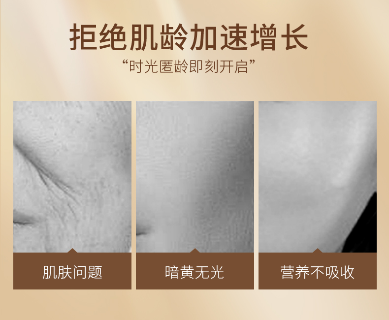 射频美容仪，射频美颜仪,射频仪,多极射频仪,卡酷尚射频仪