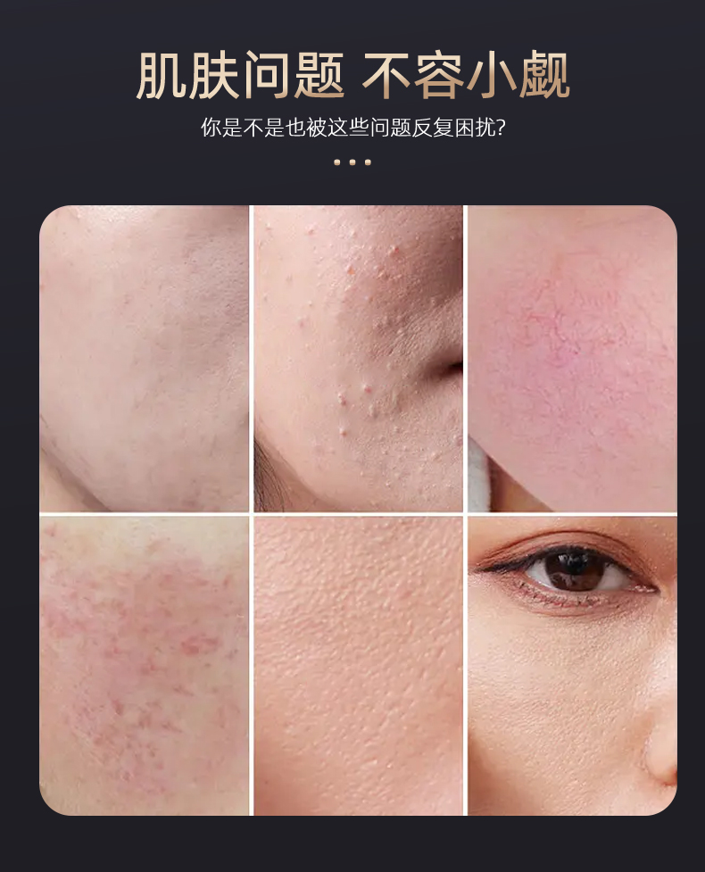 幸运草射频仪,四叶草射频仪,射频仪，RF射频仪,幸运草导入仪